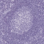 Immunohistochemical staining of human lymph node shows no positivity as expected.