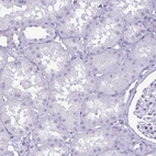Immunohistochemical staining of human kidney shows no positivity in cells in tubules as expected.