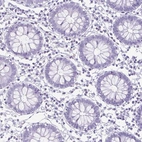 Immunohistochemical staining of human colon shows no positivity in glandular cells as expected.