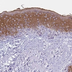 Immunohistochemical staining of human skin shows moderate cytoplasmic positivity in epidermal cells.