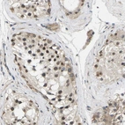 Immunohistochemical staining of human testis shows high expression.