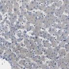 Immunohistochemical staining of human liver shows low expression as expected.