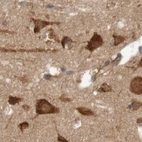Immunohistochemical staining of human cerebral cortex using Anti-LRRC47 antibody HPA012018.