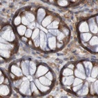 Immunohistochemical staining of human colon using Anti-LRRC47 antibody HPA012018.