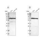 Western blot analysis using Anti-LRRC47 antibody HPA012018 (A) shows similar pattern to independent antibody HPA008512 (B).