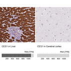 Anti-CES1 Antibody