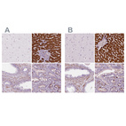 Anti-CES1 Antibody