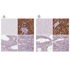 Immunohistochemical staining of human cerebral cortex, liver, prostate and upper gastrointestinal using Anti-CES1 antibody HPA012023 (A) shows similar protein distribution across tissues to independent antibody HPA046717 (B).