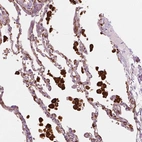Immunohistochemical staining of human lung shows strong cytoplasmic positivity in macrophages.