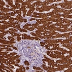 Immunohistochemical staining of human liver shows strong cytoplasmic positivity in hepatocytes.