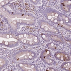 Immunohistochemical staining of human small intestine shows strong cytoplasmic positivity in enteroendocrine cells.