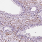 Immunohistochemical staining of human prostate shows moderate cytoplasmic positivity in smooth muscle cells.