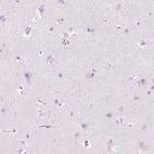 Immunohistochemical staining of human cerebral cortex shows no cytoplasmic positivity in neuronal cells as expected.
