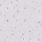 Anti-CES1 Antibody