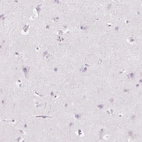 Immunohistochemical staining of human cerebral cortex shows no cytoplasmic positivity in neuronal cells as expected.