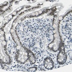 Immunohistochemical staining of human small intestine shows high expression.