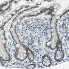 Immunohistochemical staining of human small intestine shows high expression.