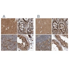 Anti-ARHGEF11 Antibody