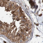 Immunohistochemical staining of human testis using Anti-ARHGEF11 antibody HPA012037.