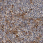 Immunohistochemical staining of human lymph node using Anti-ARHGEF11 antibody HPA012037.