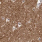 Immunohistochemical staining of human cerebral cortex using Anti-ARHGEF11 antibody HPA012037.