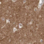 Immunohistochemical staining of human cerebral cortex using Anti-ARHGEF11 antibody HPA012037.