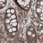 Immunohistochemical staining of human colon using Anti-ARHGEF11 antibody HPA012037.