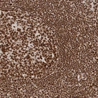 Immunohistochemical staining of human tonsil shows strong nuclear positivity in both germinal and non-germinal center cells.