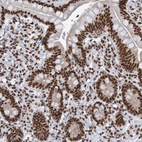 Immunohistochemical staining of human small intestine shows strong nuclear positivity in glandular cells.