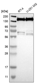 Western blot analysis in human cell line RT-4 and human cell line U-251 MG.