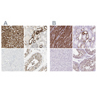 Immunohistochemical staining of human heart muscle, kidney, liver and testis using Anti-OXCT1 antibody HPA012047 (A) shows similar protein distribution across tissues to independent antibody HPA061425 (B).