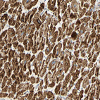 Anti-OXCT1 Antibody