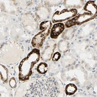 Immunohistochemical staining of human kidney shows strong cytoplasmic positivity in cells in tubules.