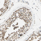 Immunohistochemical staining of human testis shows strong cytoplasmic positivity in cells in seminiferous ducts.
