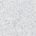 Immunohistochemical staining of human liver shows no positivity in hepatocytes as expected.