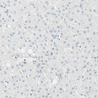 Immunohistochemical staining of human liver shows no positivity in hepatocytes as expected.