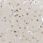 Immunohistochemical staining of human Cerebral cortex shows moderate cytoplasmic and nuclear positivity in neuronal cells.