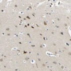 Immunohistochemical staining of human Cerebral cortex shows moderate cytoplasmic and nuclear positivity in neuronal cells.