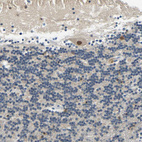 Immunohistochemical staining of human Cerebellum shows moderate nuclear positivity in Purkinje cells.