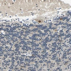 Immunohistochemical staining of human Cerebellum shows moderate nuclear positivity in Purkinje cells.