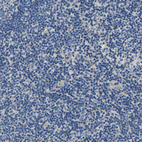 Immunohistochemical staining of human Tonsil shows very weak cytoplasmic positivity in non-germinal center cells.