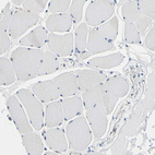Immunohistochemical staining of human Skeletal muscle shows no positivity in myocytes as expected.