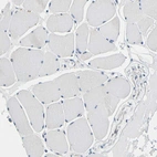 Immunohistochemical staining of human Skeletal muscle shows no positivity in myocytes as expected.