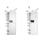 Western blot analysis using Anti-KRT23 antibody HPA012050 (A) shows similar pattern to independent antibody HPA016959 (B).