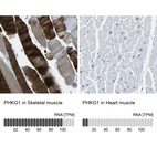 Anti-PHKG1 Antibody