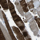 Immunohistochemical staining of human skeletal muscle shows high expression.