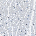 Immunohistochemical staining of human heart muscle shows low expression as expected.