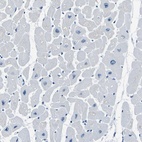 Anti-PHKG1 Antibody