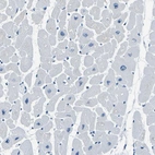 Immunohistochemical staining of human heart muscle shows low expression as expected.