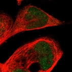 Immunofluorescent staining of human cell line A-431 shows localization to nucleus.